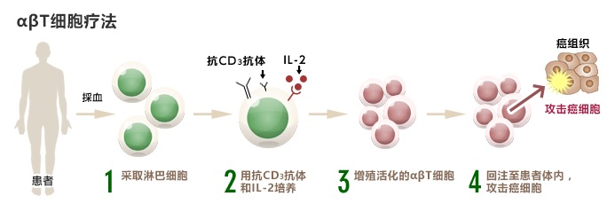αβT細(xì)胞療法