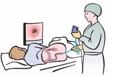 日本專家實(shí)例呼吁：不要忽視腸鏡檢查前的影像檢查